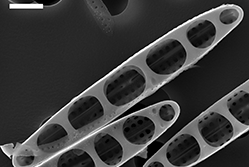 diatom